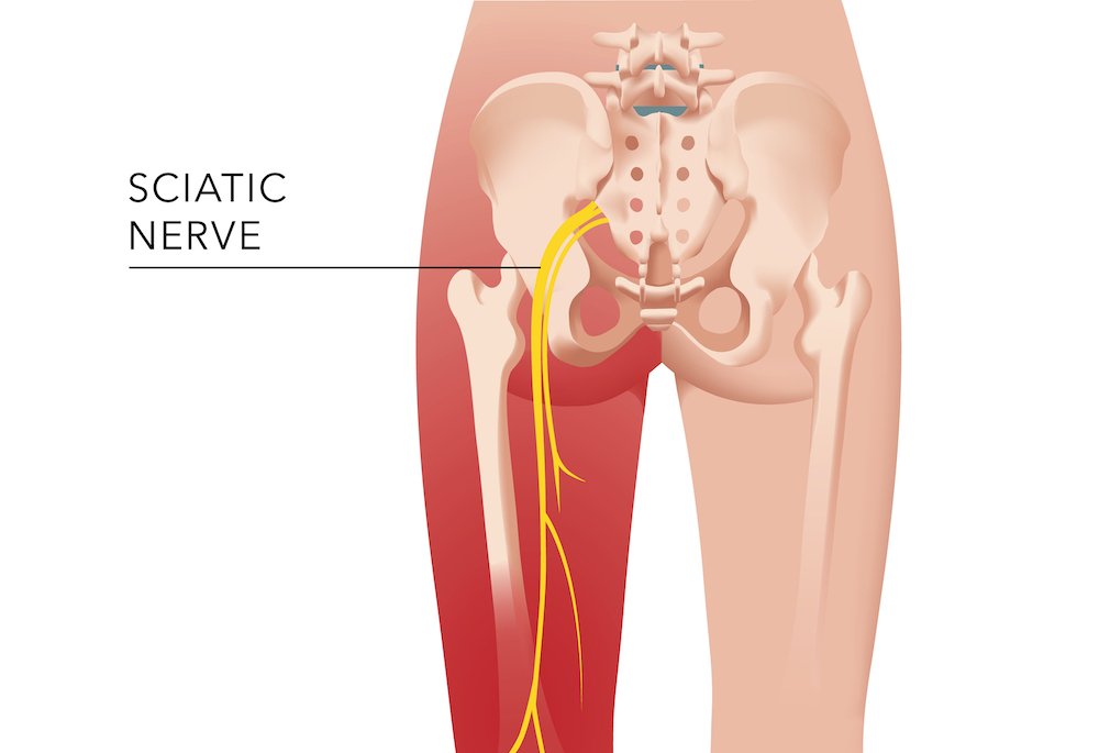 Diagram showing the sciatic nerve